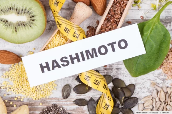 In diesem ausführlichen Artikel erfahren Sie alles wissenswerte darüber was die richtige Ernährung bei Hashimoto ist...